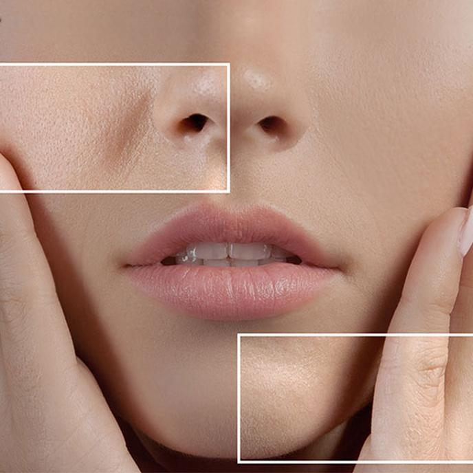 تصویر چطوری منافذ باز صورت خود را کوچیک کنیم ؟